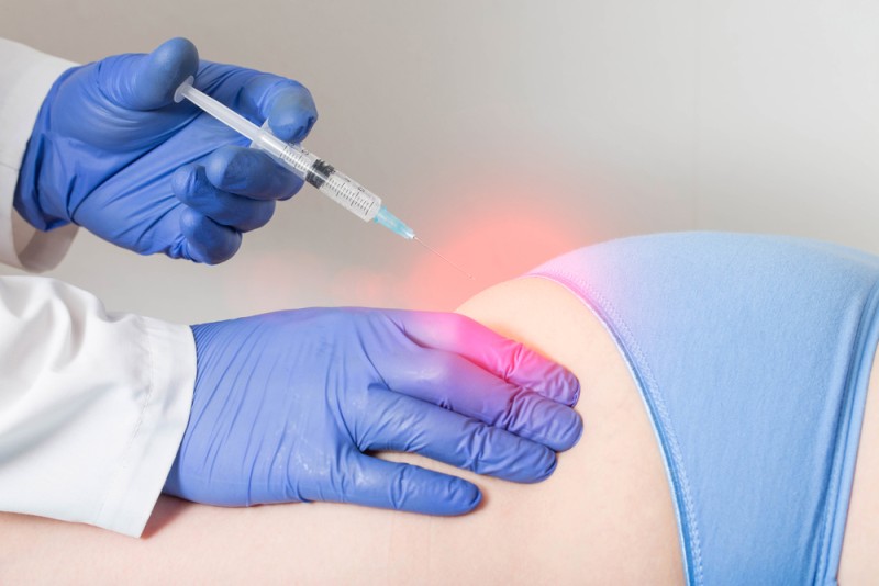 reprezentare grafica a afectarii nervului din cauza unei injectii