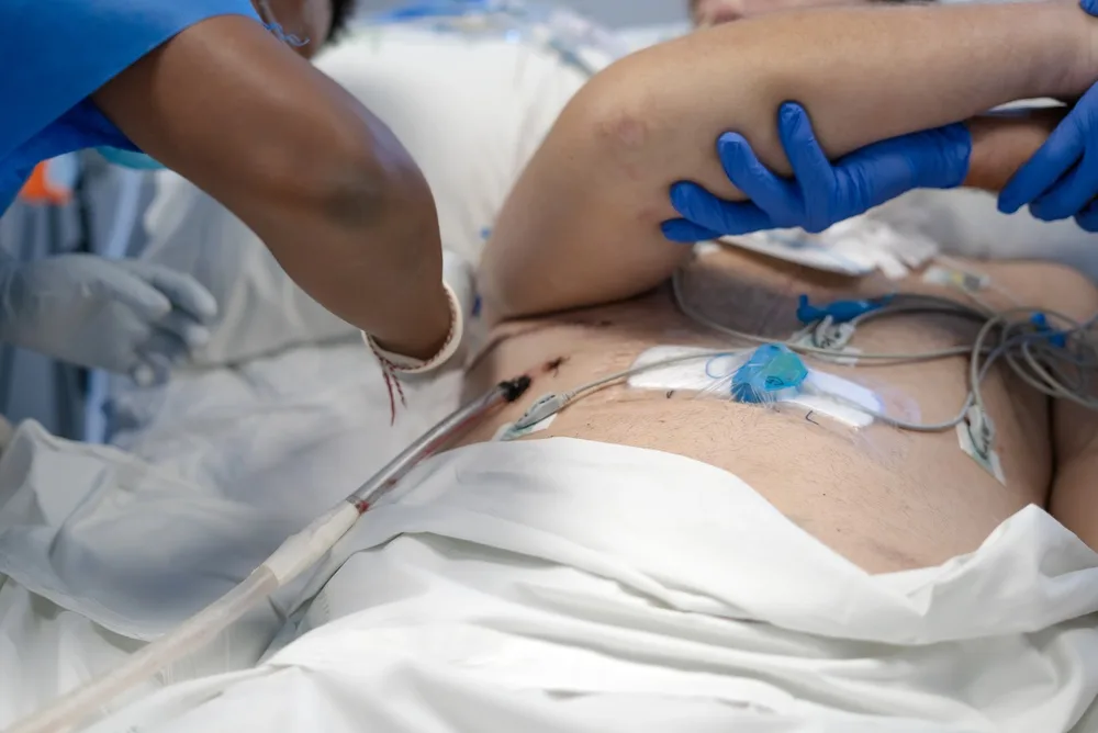 imagine cu un moment in care trebuie sa soliciti ajutor medical de urgenta
