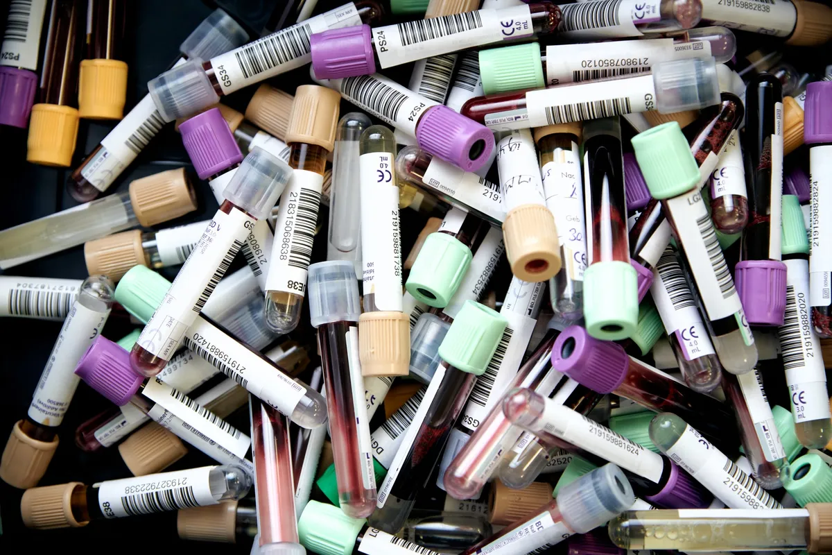 recoltarea sangelui sistem vacutainer