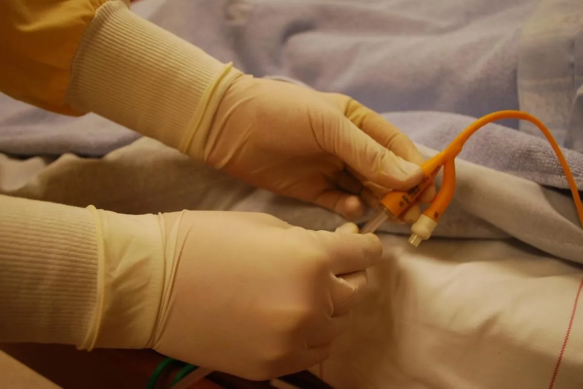 Sonda urinara ce trebuie sa stii despre acest dispozitiv medical