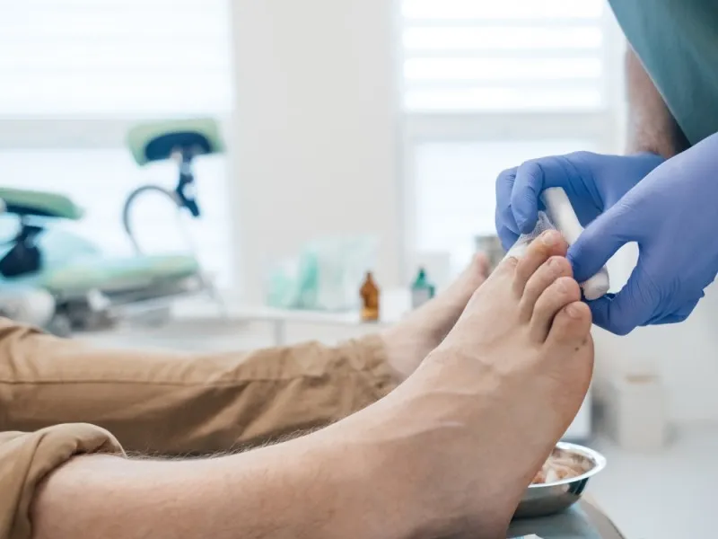 tratament medical pentru deget care coace